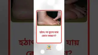 হঠাৎ পা ফুলে যায়? জানুন ৪টি সম্ভাব্য কারণ | পা ফোলার কারণ | Bangla Health Tips