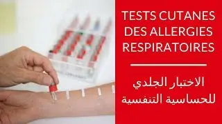 Tests cutanés des allergies respiratoires │ الاختبار الجلدي للحساسية التنفسية