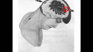 Mr. Dale K. Meyer's error and how to fix it