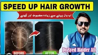 Hair fall treatment | alopecia | Dr Syed Haider Ali | Dr Syed Haider clinic | Balo Ka Girna or Ganja