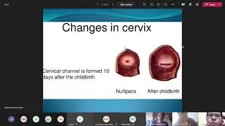 19) Normal and Abnormal Puerperium ( online ) 26/1/2021