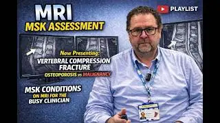 Vertebral compression fractures: How to assess on MRI