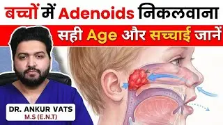 बच्चों में Adenoids Operation कब जरूरी? | Right Age Explained
