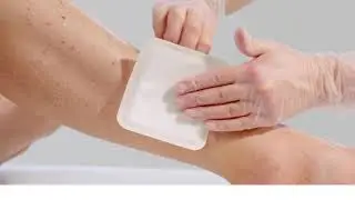 UrgoStart Plus / Ulcus cruris & Diabetisches Fu&szlig;syndrom / Einfach & zeitsparend