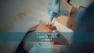 Transform Your Skin with Carbon Laser Treatment at Clinica Errami!