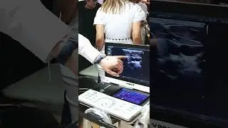 МЕЖДУНАРОДНЫЙ ФОРУМ АНЕСТЕЗИОЛОГОВ - РЕАНИМАТОЛОГОВ мастер класс на аппарате УЗИ Vinno 8 #shorts