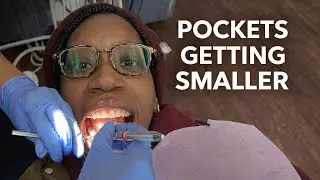 My Gum Pockets Keep Improving! 🤩Dental Update! #dentalhealth #healthygums #wellnessjourney 