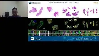 Highly multiplexed digital spatial profiling of the tumor microenvironment...