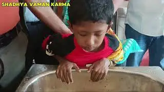 Childhood bronchial asthma case has done SHADHYA VAMAN KARMA under Dr. Harishankar Chaudhary
