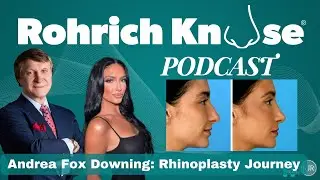 Andrea Fox Downing: Rhinoplasty Journey