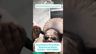 Hollywood carbon laser facial #skincare  #tanning #hyperpigmentation #aesthetic #jankipuram #lucknow