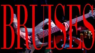 ECHOS &mdash; BRUISES  | LEXI NORTON  | 2025 AI MUSIC SFX VIDEO  | From the Album 
