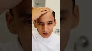 Bu zardob bilan 10 kunda soch to&rsquo;kilishi qoladi