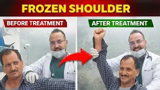 FROZENSHOULDER TREATMENT #viddkarma #marmatherapy #healingjourney #health #motivation 