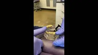 Flossing an Implant