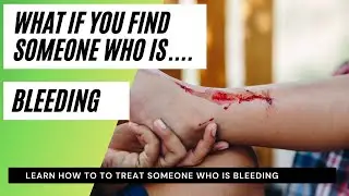 What if you find someone who is bleeding