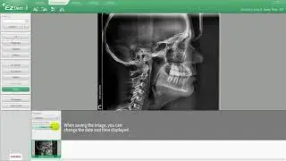 Ezdent I ACQUISITION Tab 04 Import Pano, Ceph, CT Images