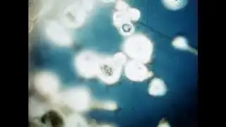 Interference microscopy of normal and cancer cells in tissue culture (1958)