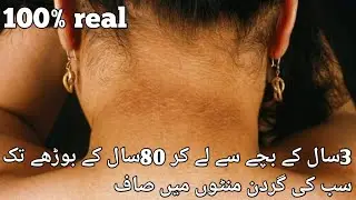 How to lighten dark neck spots|natural treatment 