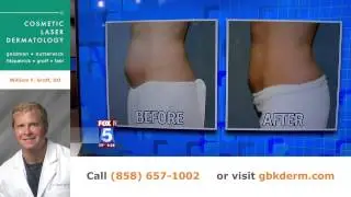 Skin Care Q&A with Dr. Groff | Expert San Diego Dermatologist
