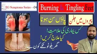 Burning Feet: Causes, Treatment Expert Advice: | Urdu/Hindi | Dr. Ali Hassan