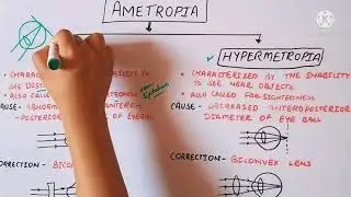 Refractive errors of human eye (in hindi) | Errors of refraction| Eduluminescence
