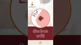 Breast Cancer Surgery, Oncological Surgery, Patient Review, Breast Lump Removal, Surat, Gujarat.