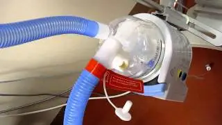 Vent set up