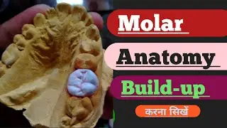Upper Molar Anatomy Porcelain Technique|| Ceramic build up video| posterior Anatomy| Anterior | lab