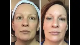 RESULTS ARE IN 12 Day Home Use Microcurrent Challenge