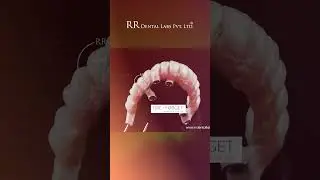 Fire and forget powered by RR Dental Lab