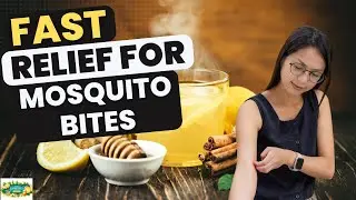 Get Fast Relief from Mosquito Bite Itch | Top Home Remedies to Soothe and Heal Naturally