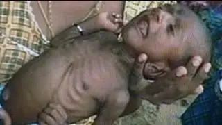 Congress' ad controversy: Lankan refugees or Gujarat malnourished?