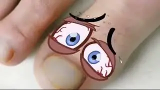Fungi Nail Toe & Foot TV Spot, 'Lock in the Medicine' -  Talking  Male Foot Commercial