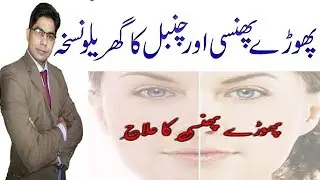 Phoray phunsi ka ilaj in urdu || in hindi ||Phora phinsi chambal Dad ka desi nuskha