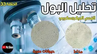 Urinalysis 33 microscopic ex (Sperm & Mucus)