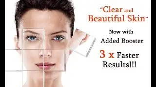 🎧 Clear and Beautiful Skin with Added Booster by Simply Hypnotic | Perfect Skin Binaural Recording