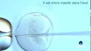 Sais-tu ce qu'est l'ICSI ?