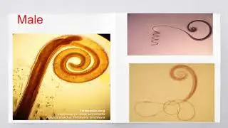 Trichuris trichiura section (3rd year 2020/2021 - traditional)
