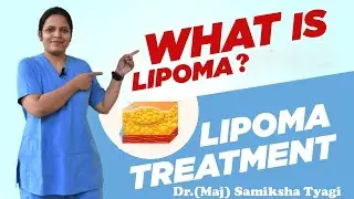 Multiple Lipomatosis, What is Lipoma(Fat Lump Under Skin)? How to cure ? How Lipoma can be Treated?