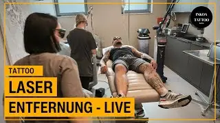 Tattoo-Entfernung live: Gesicht, Hals & Hände unter dem Laser 🔥 | Inkoa Tattoo Berlin