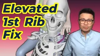 First Rib Joint Mobilization: A New Hope for Shoulder Pain?