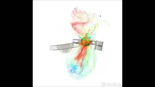 FlowVision CFD   Blood Streamlines in LHHM Left during Diastole, 1 Way FSI 170407