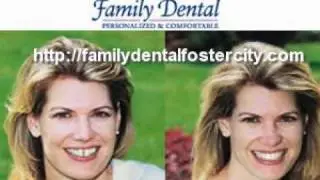Dentist  Foster City, CA