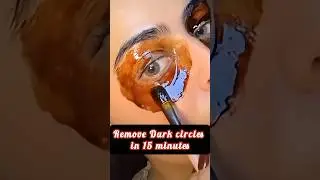 dark circles #shorts #viralvideo #trending #darkcircles #beauty #fyp #music#song#ytshorts #skincare