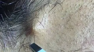 ASMR Plucking Beard Daily Routine Hair Removal Satisfying