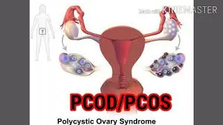 நீர்க்கட்டி மாதவிடாய் பிரச்சனை நிரந்தர தீர்வு /permanent solution for irregular period