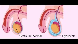 Scrotal exploration CPT code - simplify medical coding