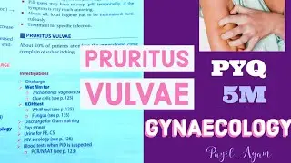 Pruritus Vulvae Gynaecology in 3mins TAMIL OBGImportant Question|#bhms #gynaecology #mbbs #obg#bsms