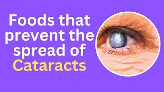 Foods that prevent the spread of Cataracts
